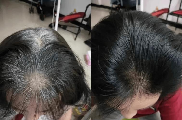 白头发越长越多 别以为是老了 可能是缺乏这3种营养